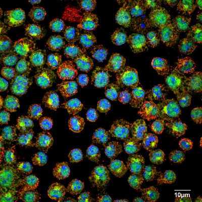 Mast Cells2