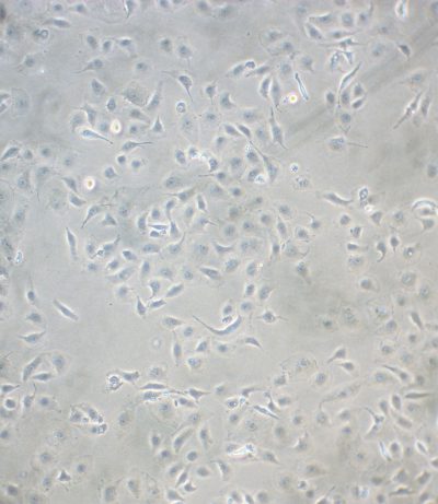 Endothelial Cells