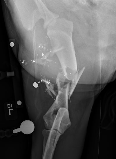 822570 Cc Humerus Fx Pre Op Crop