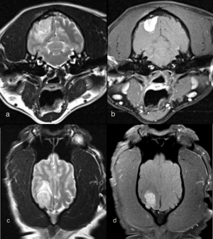 Louie Mri