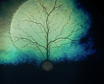 Eye Scan