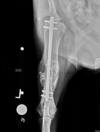822570 Cc Humerus Fx 10Wks