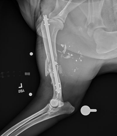 822570 Ml Humerus Fx 00Wks