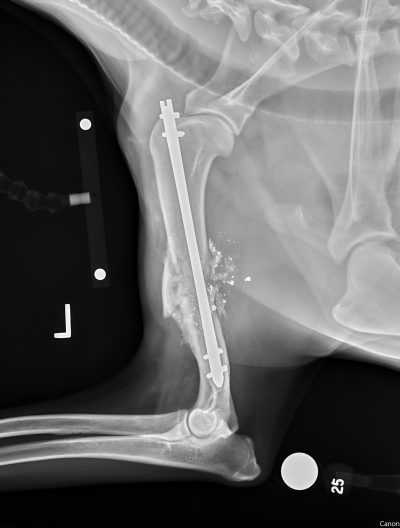 822570 Ml Humerus Fx 10Wks