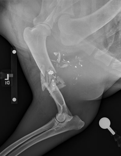 822570 Ml Humerus Fx Pre Op
