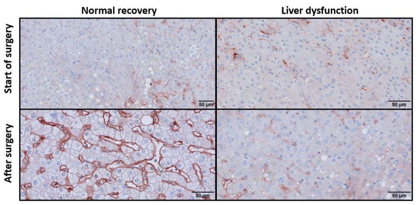 Human Liver Fibrin