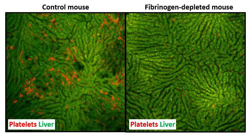 Mouse Liver Fibrin