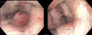 Larynx 6Mo Web