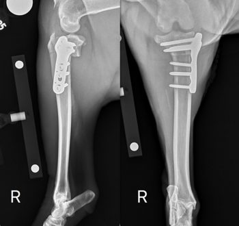 Elsa Radiographs 2 Use