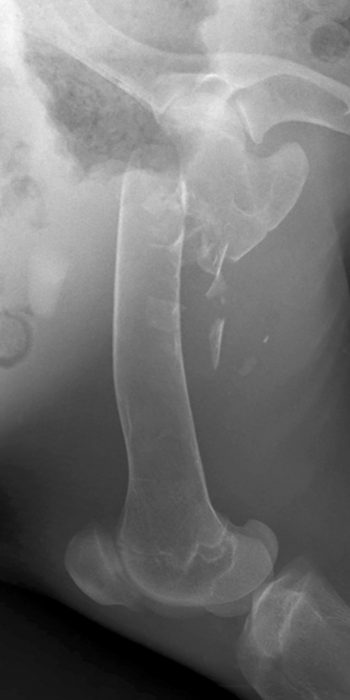 Kora Radiographs Use