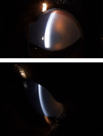 Left And Right Eyes 2
