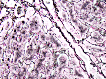 Liver Reticulin