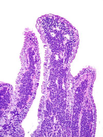 Differentiating Feline Intestinal Lymphoma from Inflammatory Bowel ...