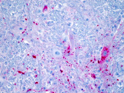 Immunohistochemical Labeling Red For Cdv In The Brain Of A Dog