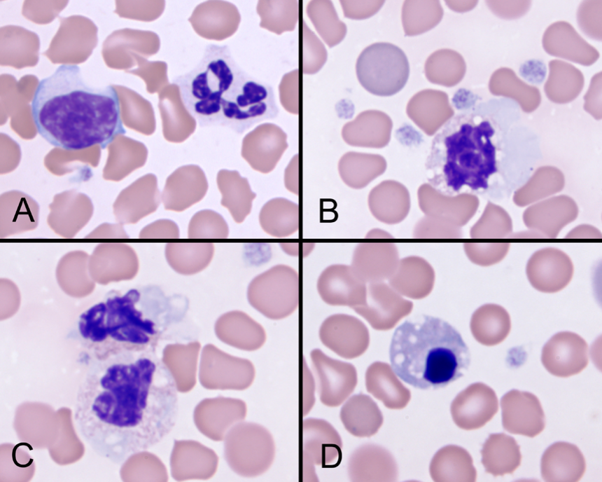 Clinical Pathology Smear