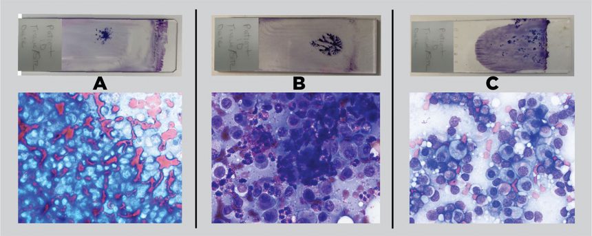 Cytology Figure 1