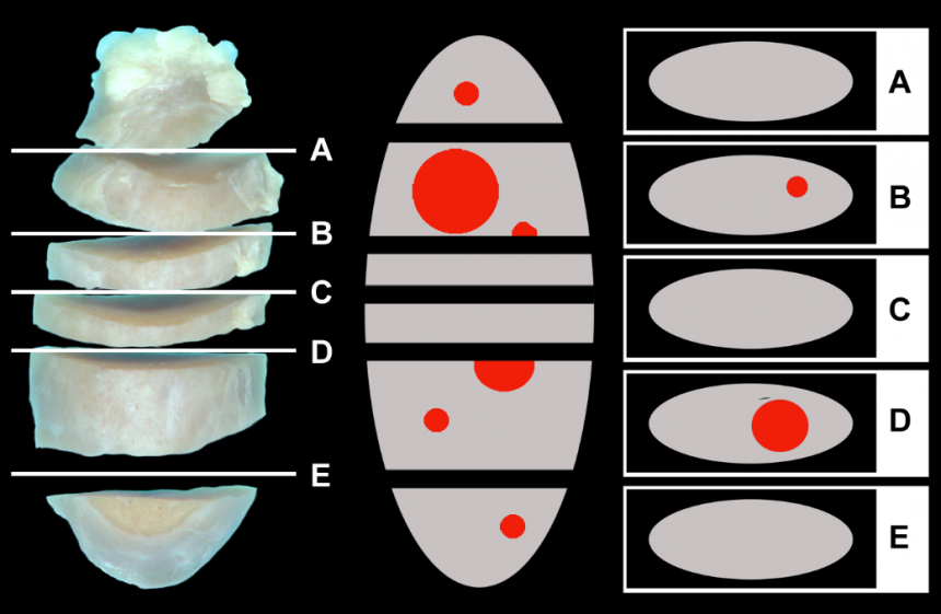 Sections Of Lymph Node